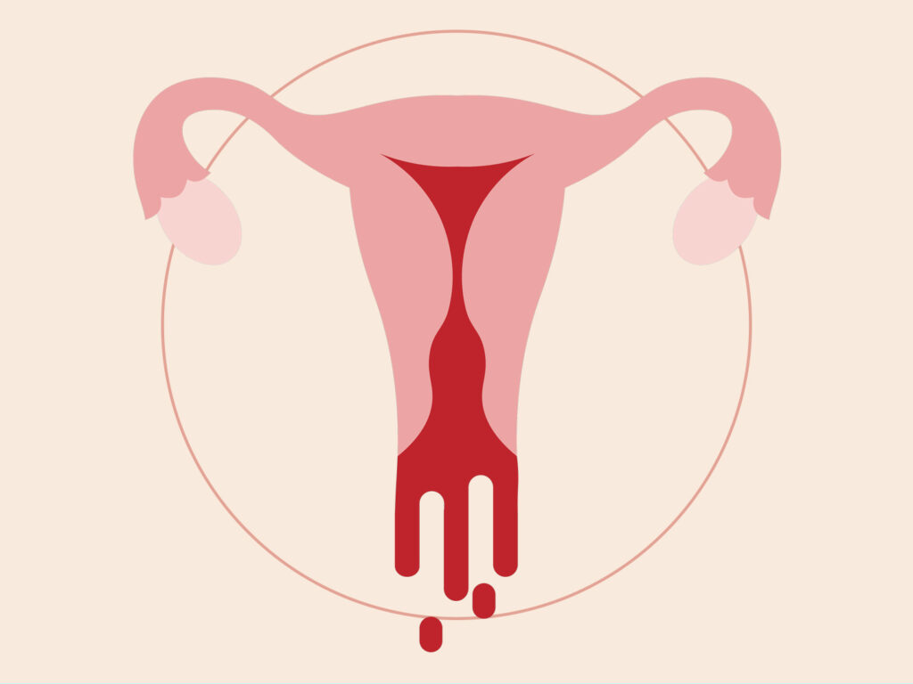 heavy periods, menstruation, uterus, blood