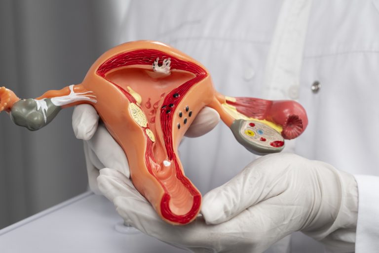 Doctor holding a model of internal female genitalia.