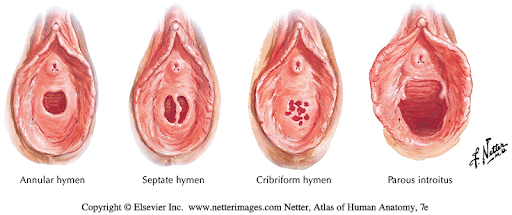 Medical diagrams of various types of hymens; annular, septate, cribriform, parous.